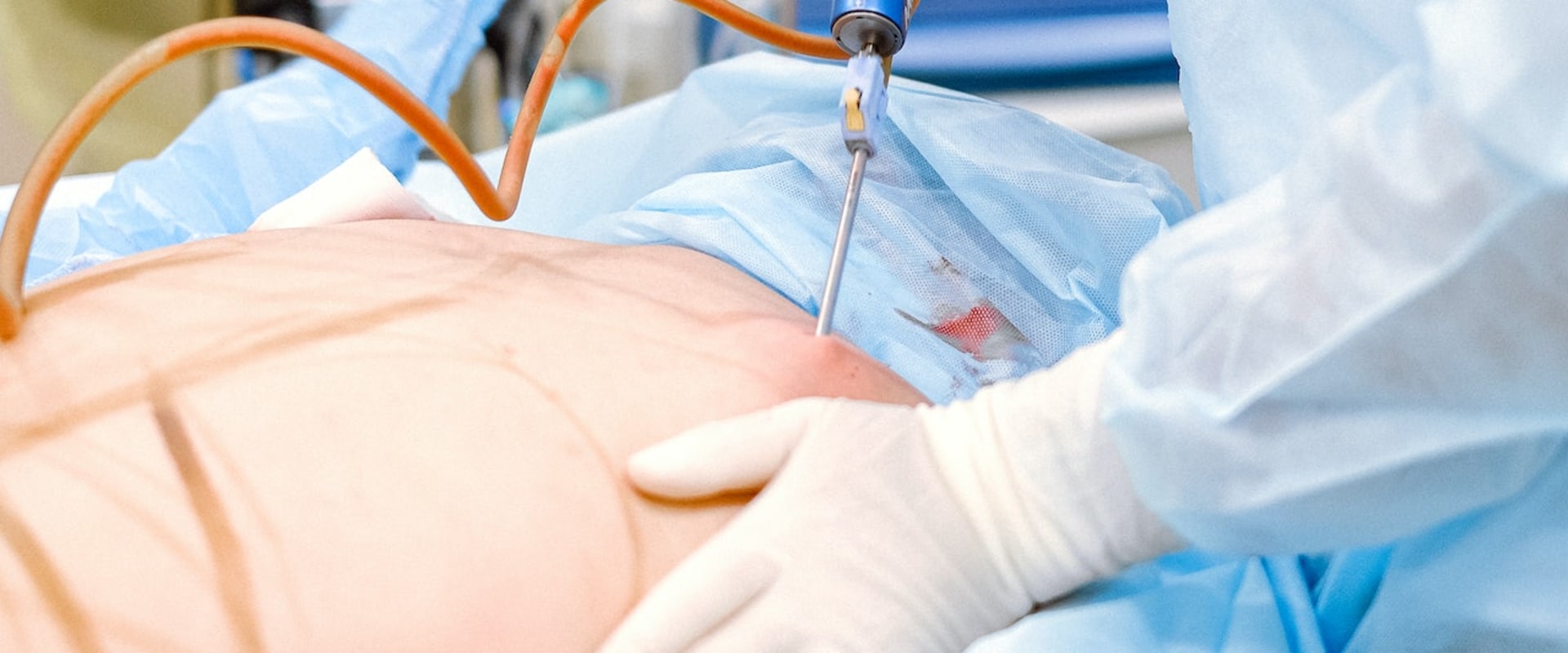 How Liposuction Can Help You Achieve Mind-Body Wellness In Las Vegas